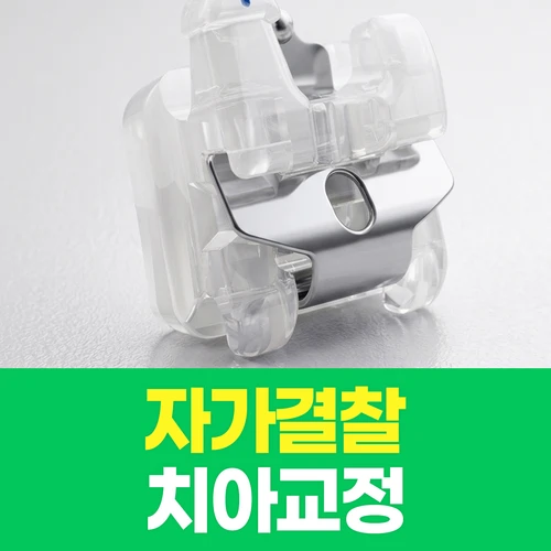 자가결찰교정