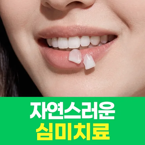 심미치료